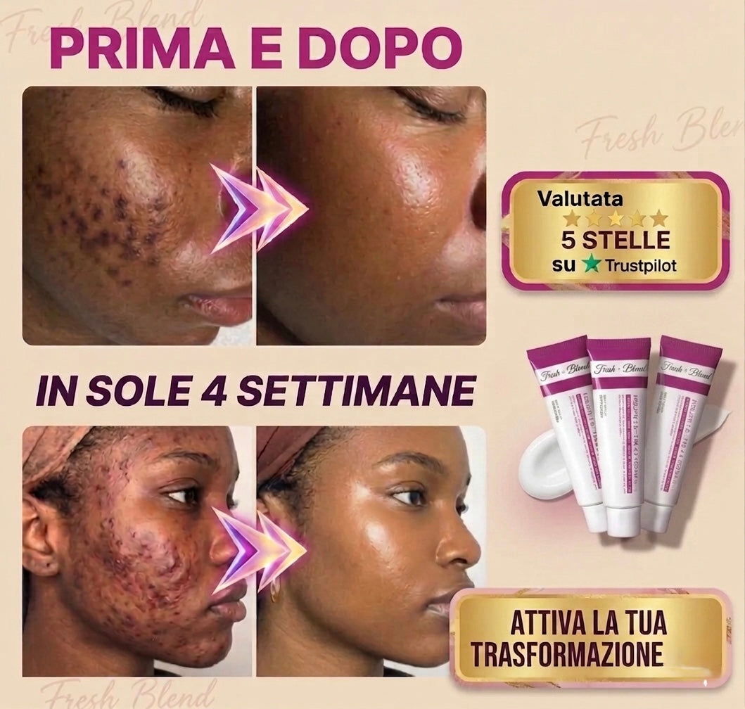Clear Skin Routine — 3 Creme Studiate per Lavorare Insieme
